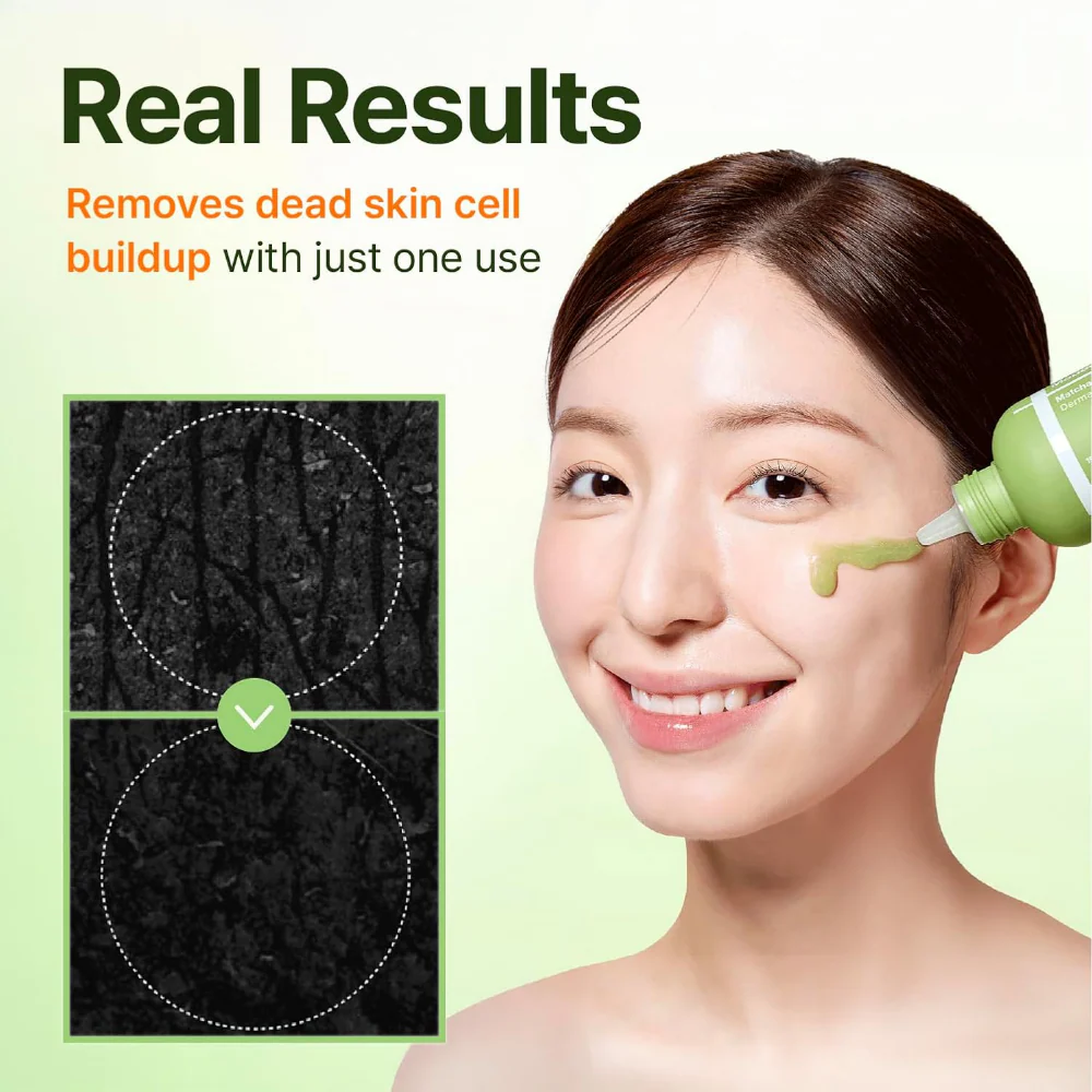 Centellian24 Madeca Matcha Toning Peeling Gel 150ml - Image 4