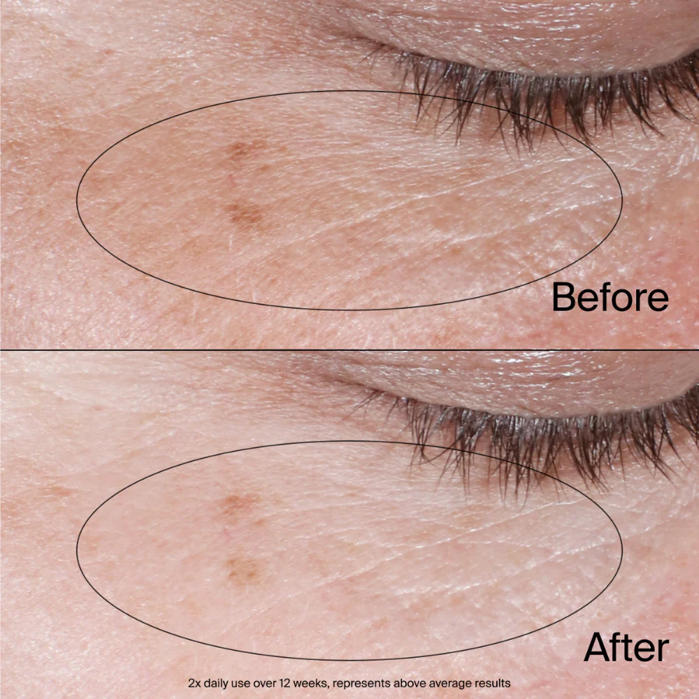 Neutrogena Collagen Bank Reviving Eye Gel Cream 15g - Image 4